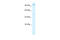 Zinc Finger Homeobox 2 antibody, 27-536, ProSci, Western Blot image 