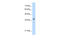 LIM Domain Binding 1 antibody, 28-731, ProSci, Western Blot image 