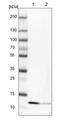 Stress Associated Endoplasmic Reticulum Protein 1 antibody, NBP2-54686, Novus Biologicals, Western Blot image 