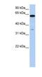 Karyopherin Subunit Alpha 6 antibody, NBP1-52953, Novus Biologicals, Western Blot image 