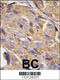 Eukaryotic Translation Initiation Factor 4B antibody, 60-585, ProSci, Immunohistochemistry paraffin image 