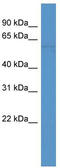 Selenoprotein N antibody, TA342465, Origene, Western Blot image 