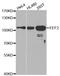 Eukaryotic Translation Elongation Factor 2 antibody, MBS128044, MyBioSource, Western Blot image 
