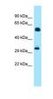 Inositol Hexakisphosphate Kinase 1 antibody, orb331181, Biorbyt, Western Blot image 