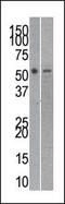 RuvB Like AAA ATPase 2 antibody, MBS9210678, MyBioSource, Western Blot image 