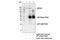 Rho Associated Coiled-Coil Containing Protein Kinase 1 antibody, 4035S, Cell Signaling Technology, Immunoprecipitation image 