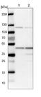 Hydroxymethylbilane Synthase antibody, NBP1-87329, Novus Biologicals, Western Blot image 