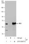 Malic Enzyme 2 antibody, GTX130673, GeneTex, Immunoprecipitation image 