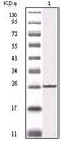 Inhibitor Of Nuclear Factor Kappa B Kinase Subunit Beta antibody, MA5-15320, Invitrogen Antibodies, Western Blot image 