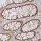 KIAA1191 antibody, NBP2-48891, Novus Biologicals, Immunohistochemistry paraffin image 