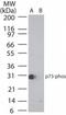 Tumor Protein P73 antibody, TA336320, Origene, Western Blot image 