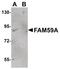 GRB2 Associated Regulator Of MAPK1 Subtype 1 antibody, PA5-20845, Invitrogen Antibodies, Western Blot image 