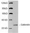 Calbindin 1 antibody, LS-C203095, Lifespan Biosciences, Western Blot image 
