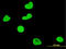 Serum/Glucocorticoid Regulated Kinase 1 antibody, LS-B5532, Lifespan Biosciences, Immunofluorescence image 