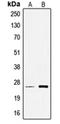 Transcription Elongation Factor A Like 6 antibody, orb215387, Biorbyt, Western Blot image 