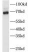 TATA-Box Binding Protein Associated Factor 6 Like antibody, FNab08487, FineTest, Western Blot image 