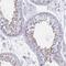 Saccharopine Dehydrogenase (Putative) antibody, PA5-62239, Invitrogen Antibodies, Immunohistochemistry frozen image 
