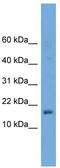 GSK3-beta interaction protein antibody, TA345022, Origene, Western Blot image 