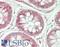 Glucosidase II Alpha Subunit antibody, LS-B14411, Lifespan Biosciences, Immunohistochemistry paraffin image 