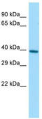 Protein Geranylgeranyltransferase Type I Subunit Beta antibody, TA346734, Origene, Western Blot image 