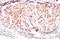 Gasdermin D antibody, GTX636896, GeneTex, Immunohistochemistry paraffin image 