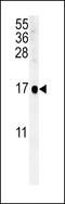 Suppressor Of IKBKE 1 antibody, 61-907, ProSci, Western Blot image 