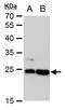 Lin-7 Homolog A, Crumbs Cell Polarity Complex Component antibody, GTX631106, GeneTex, Western Blot image 