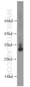 Transmembrane Protein 38A antibody, 19920-1-AP, Proteintech Group, Western Blot image 