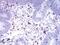 CD2 Molecule antibody, NBP2-61727, Novus Biologicals, Immunohistochemistry paraffin image 