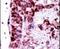 Adenylate Kinase 2 antibody, PA5-15429, Invitrogen Antibodies, Immunohistochemistry paraffin image 