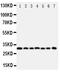Kallikrein Related Peptidase 11 antibody, PA1631, Boster Biological Technology, Western Blot image 