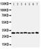 Kallikrein-11 antibody, PA1631, Boster Biological Technology, Western Blot image 