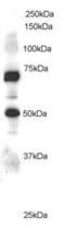 Engulfment And Cell Motility 1 antibody, PA5-18001, Invitrogen Antibodies, Western Blot image 