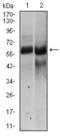 Hyaluronan synthase 2 antibody, GTX60647, GeneTex, Western Blot image 