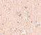 Mediator Complex Subunit 28 antibody, A08611, Boster Biological Technology, Immunohistochemistry paraffin image 