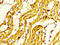MyHC-slow antibody, LS-C674314, Lifespan Biosciences, Immunohistochemistry paraffin image 
