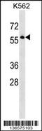 Septin 8 antibody, 58-752, ProSci, Western Blot image 