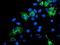 Sirtuin 5 antibody, TA503282, Origene, Immunofluorescence image 