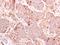 Interferon Induced With Helicase C Domain 1 antibody, PA5-27848, Invitrogen Antibodies, Immunohistochemistry frozen image 