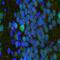 Adenylate Cyclase 3 antibody, NBP1-92683, Novus Biologicals, Immunofluorescence image 