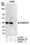 Rab Geranylgeranyltransferase Subunit Beta antibody, A304-323A, Bethyl Labs, Immunoprecipitation image 