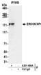 ERCC Excision Repair 5, Endonuclease antibody, A301-484A, Bethyl Labs, Immunoprecipitation image 
