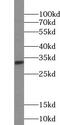 Tetraspanin 15 antibody, FNab09058, FineTest, Western Blot image 