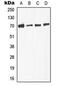 Transforming Growth Factor Beta Receptor 2 antibody, GTX32359, GeneTex, Western Blot image 