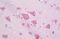Casein Kinase 1 Epsilon antibody, MBS244304, MyBioSource, Immunohistochemistry paraffin image 