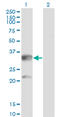 Carbonyl Reductase 3 antibody, LS-C196828, Lifespan Biosciences, Western Blot image 