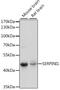 Serpin Family I Member 1 antibody, A15703, ABclonal Technology, Western Blot image 