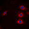 HECT, C2 And WW Domain Containing E3 Ubiquitin Protein Ligase 2 antibody, GTX56038, GeneTex, Immunofluorescence image 