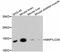 Microtubule Associated Protein 1 Light Chain 3 Alpha antibody, 14-019, ProSci, Western Blot image 