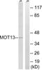 Solute Carrier Family 16 Member 13 antibody, GTX87317, GeneTex, Western Blot image 